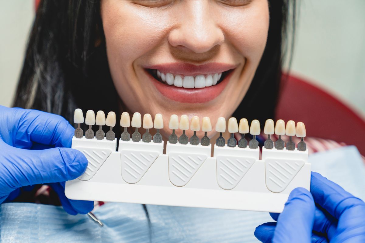 Can Veneers Be Removed