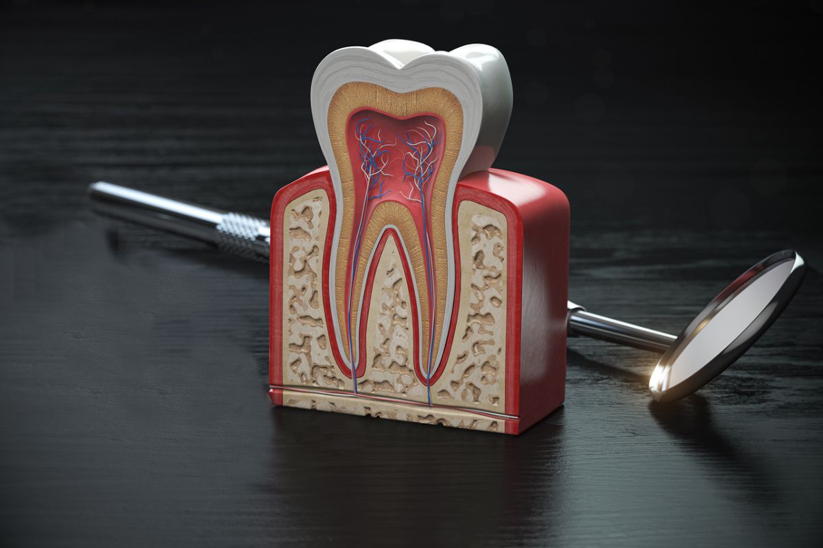 Is a Broken Root Canal Tooth an Emergency Newport Beach