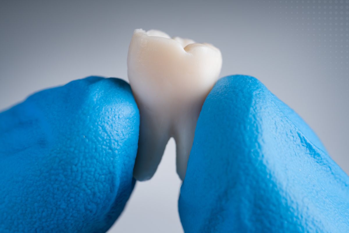 Early Signs of Enamel Erosion
